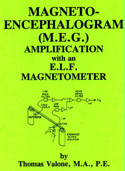 Magnetoencephalogram Amplification